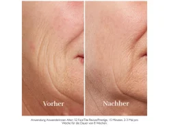 FaceTite Essentials antiverouderingsapparaat H2120/H2130